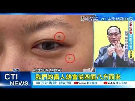 墨有毛風水|癦癦痣面相｜眉上有痣旺夫、眼角有癦多桃花？脫癦前 